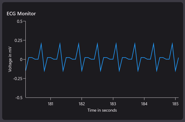 ECG monitor chart